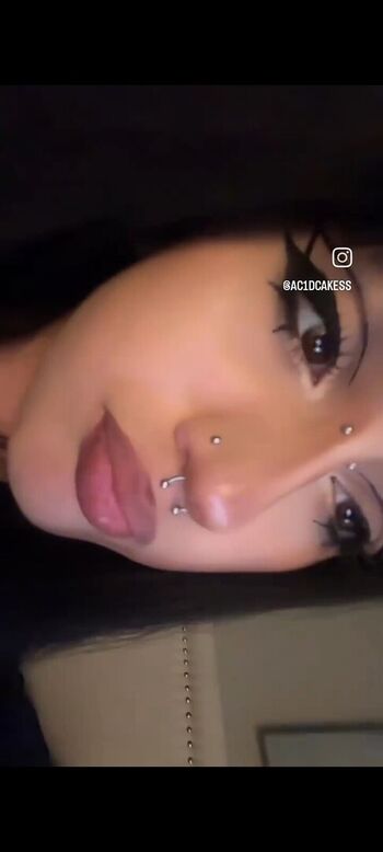 elsmerize